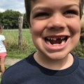 JB Lost Another Tooth